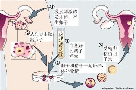 生殖中心